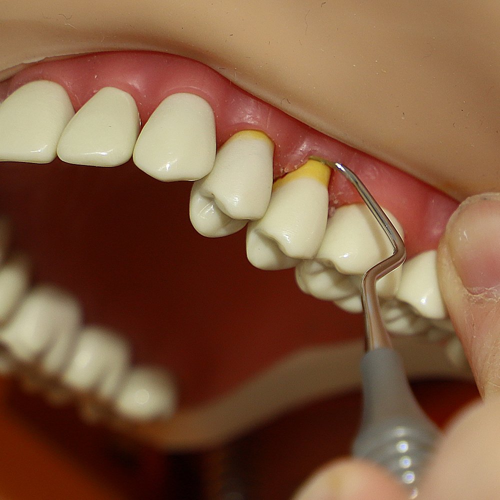 Dentine Enamel Teeth